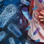 Uzman uyarısı: Salmonella sadece mideyi değil organları da etkiliyor