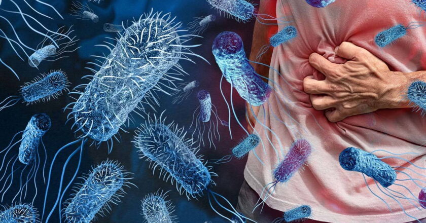 Uzman uyarısı: Salmonella sadece mideyi değil organları da etkiliyor
