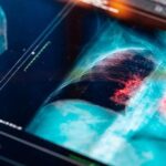 Sigara İçmeyenlerde Akciğer Kanseri Görülmesinin Sebepleri Neler?